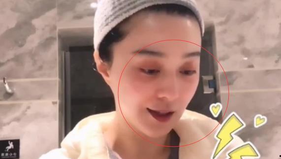 明星 嘴唇发紫,揭秘嘴唇发紫的神秘面纱